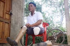 Tôi có chân!: 20 năm tìm lại đôi chân