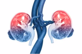 Chú ý 7 điều này để giữ cho thận khỏe mạnh