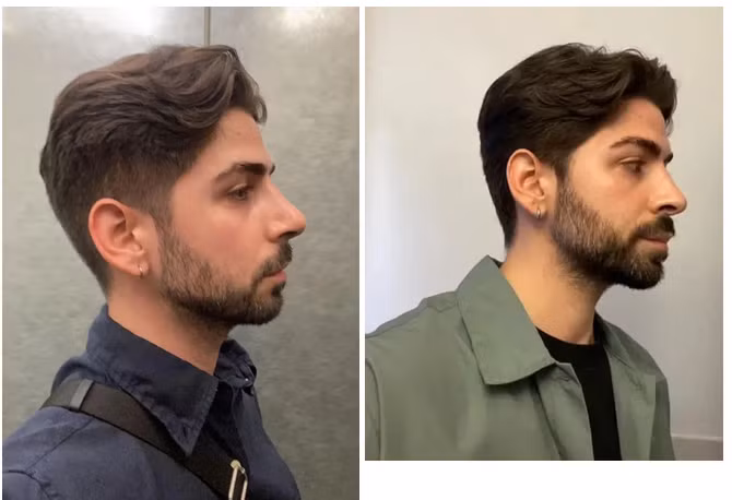 radar-khoe-dep-dd.png
