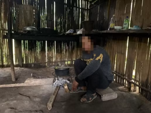 xoa-bo-hu-tuc-2.png
