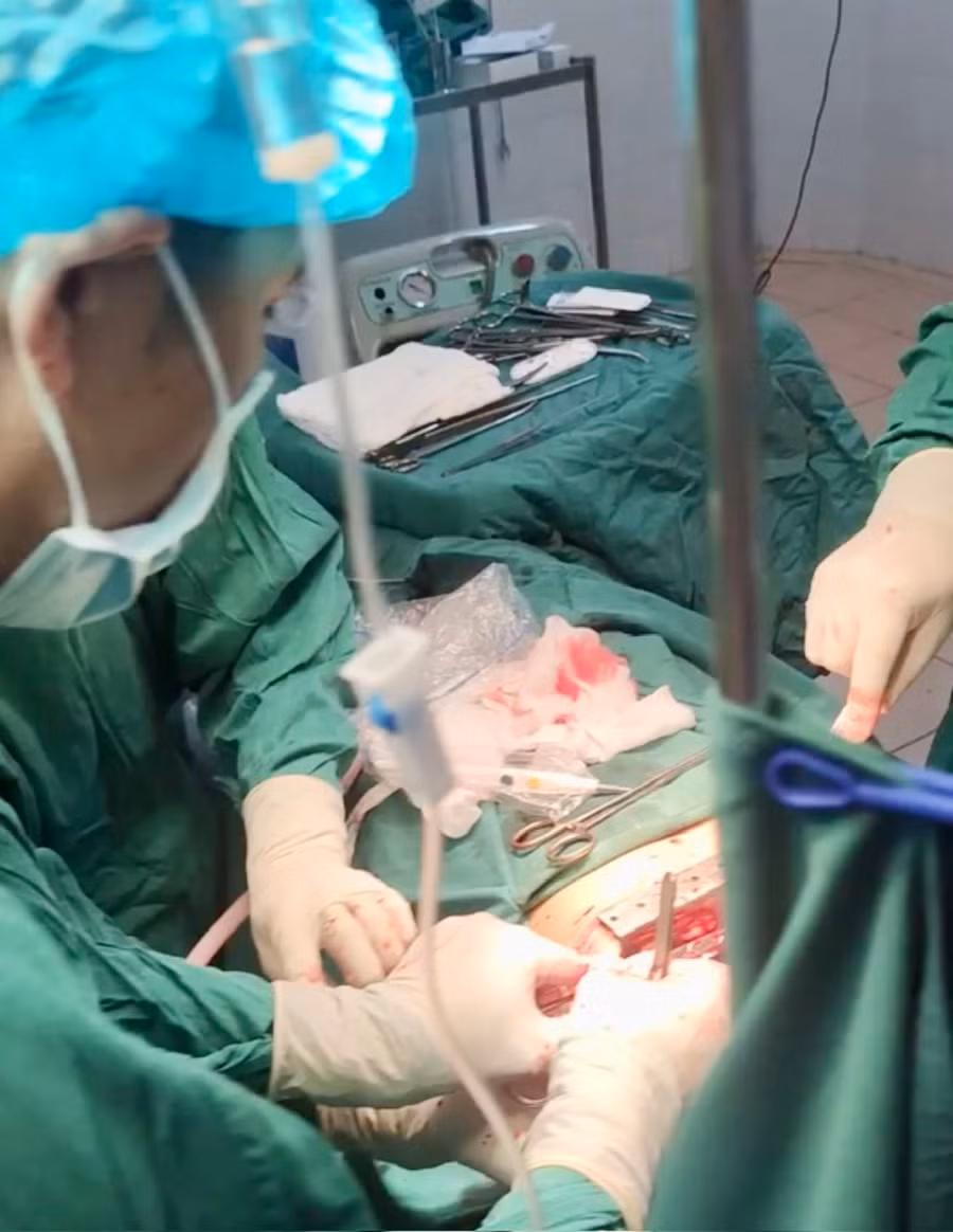 Ê kíp y, bác sĩ tiến hành phẫu thuật cho bệnh nhân. Ảnh: Như Nguyện