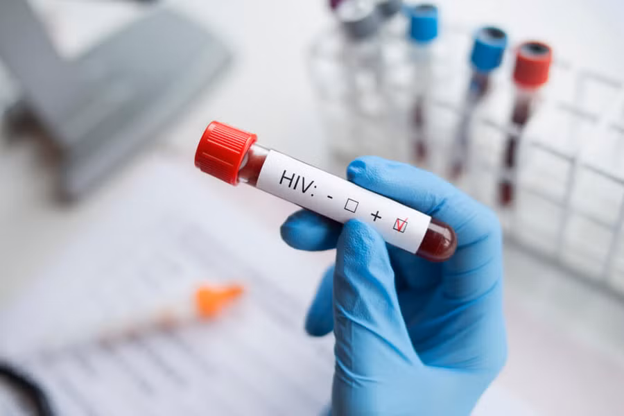 Điều kiện xác định người bị phơi nhiễm HIV, người bị nhiễm HIV do tai nạn rủi ro nghề nghiệp