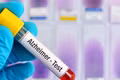 Xét nghiệm máu và chụp MRI nhanh mở hướng rút ngắn chẩn đoán Alzheimer