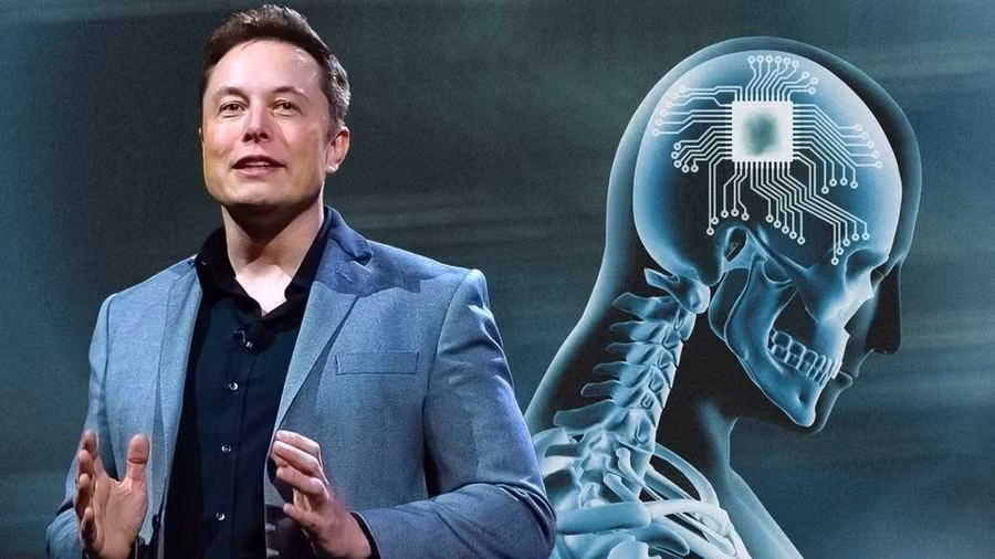 cong-ty-cua-elon-musk-dat-dot-pha-cong-nghe-voi-thoi-gian-cay-ghep-khong-tuong.jpg
