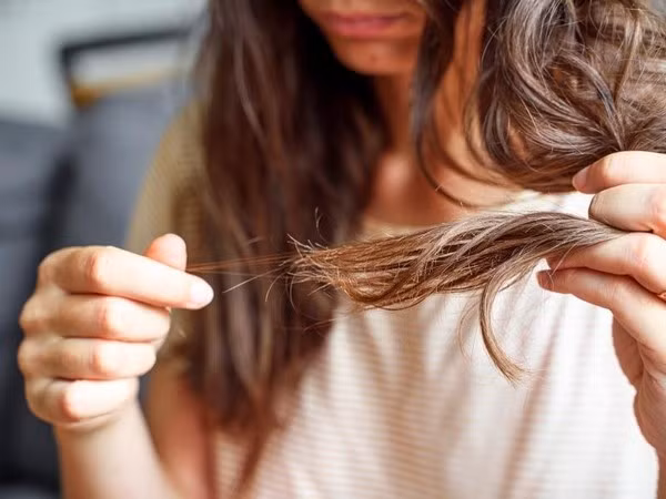 Chỉ với giấm táo, bạn đã có thể “giải cứu” mái tóc khỏi tình trạng gàu, xơ rối. Ảnh: Internet