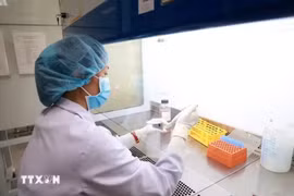 Điều tra, xử lý vụ nghi ngờ ngộ độc thực phẩm tại Huế