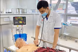Những ngộ nhận về “thần dược” chống đột quỵ