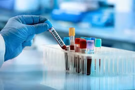Khoảng 70% ca nhiễm HIV mới tại Việt Nam xuất phát từ quan hệ tình dục không an toàn