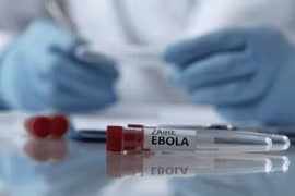Bộ Y tế hoả tốc yêu cầu các bệnh viện tăng cường phòng chống dịch Ebola