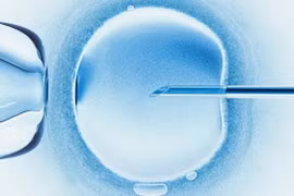 Em bé đầu tiên trên thế giới được thụ thai bằng phương pháp 'IVF tự động' đã chào đời
