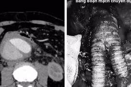 Du khách nước ngoài nguy kịch, bác sĩ Việt cứu sống ngoạn mục