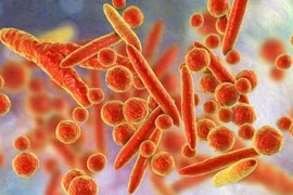 WHO bác thông tin về virus lạ gây triệu chứng ho ra máu ở Nga