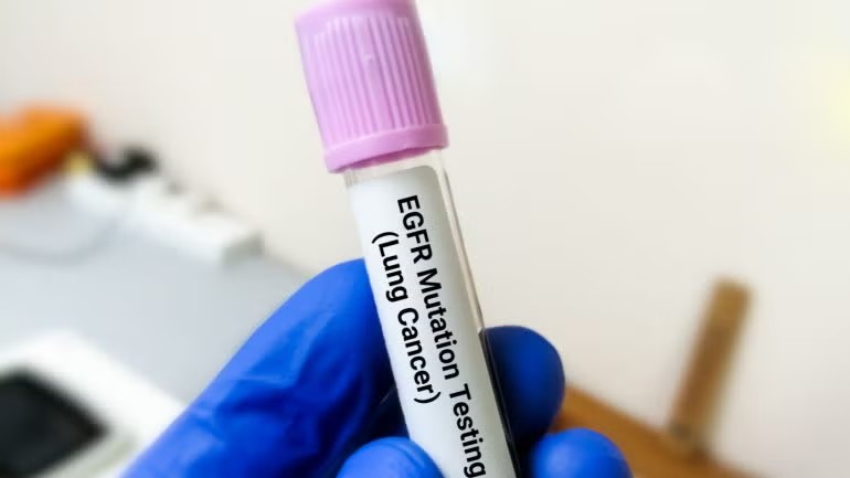 Thuốc Datroway được FDA chấp thuận trong điều trị ung thư phổi không tế bào nhỏ. (Ảnh: Pharmaceutical-technology.com) w74yomdg.png