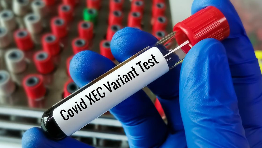 Xét nghiệm biến thể Xec của Covid (Nguồn: Quatidiano.net) quotidianonet.jpg
