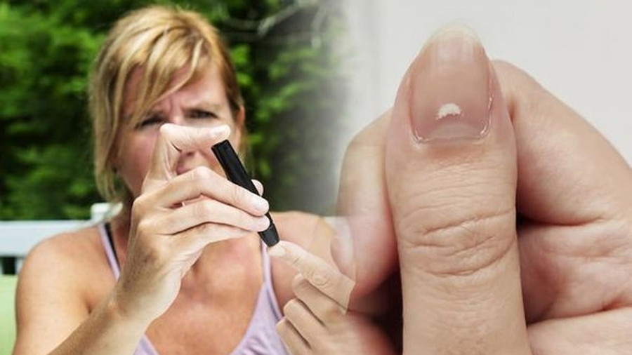 Những thay đổi về màu sắc và độ dày của móng có thể báo hiệu bệnh trước khi xuất hiện các triệu chứng khác. Ảnh: Shutterstock