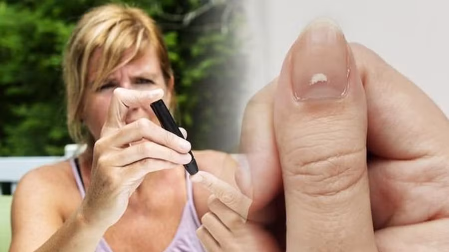 Những thay đổi về màu sắc và độ dày của móng có thể báo hiệu bệnh trước khi xuất hiện các triệu chứng khác. Ảnh: Shutterstock