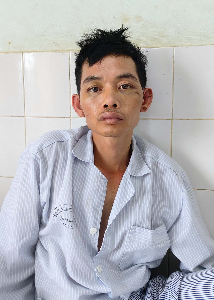 Đối tượng Ngũ Văn Luân đang điều trị tại Bệnh viện Đa Khoa tỉnh. Ảnh: Lê Anh