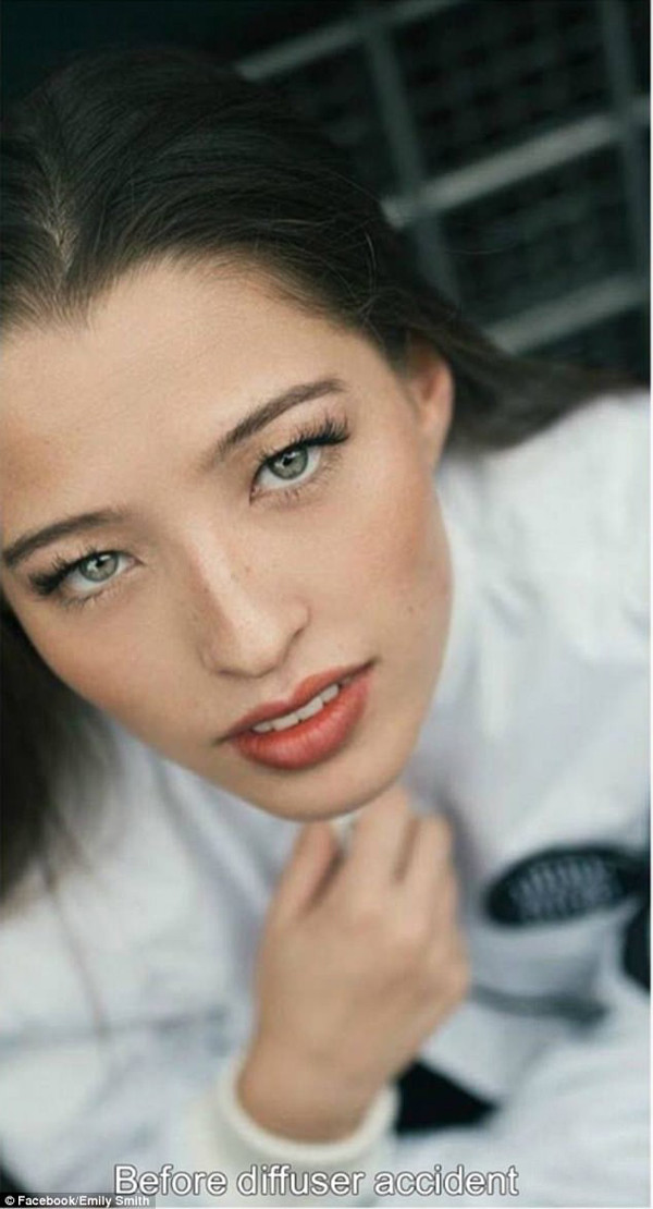 Khuôn mặt Emily trước khi gặp sự cố. Khuôn mặt Emily trước khi gặp sự cố.