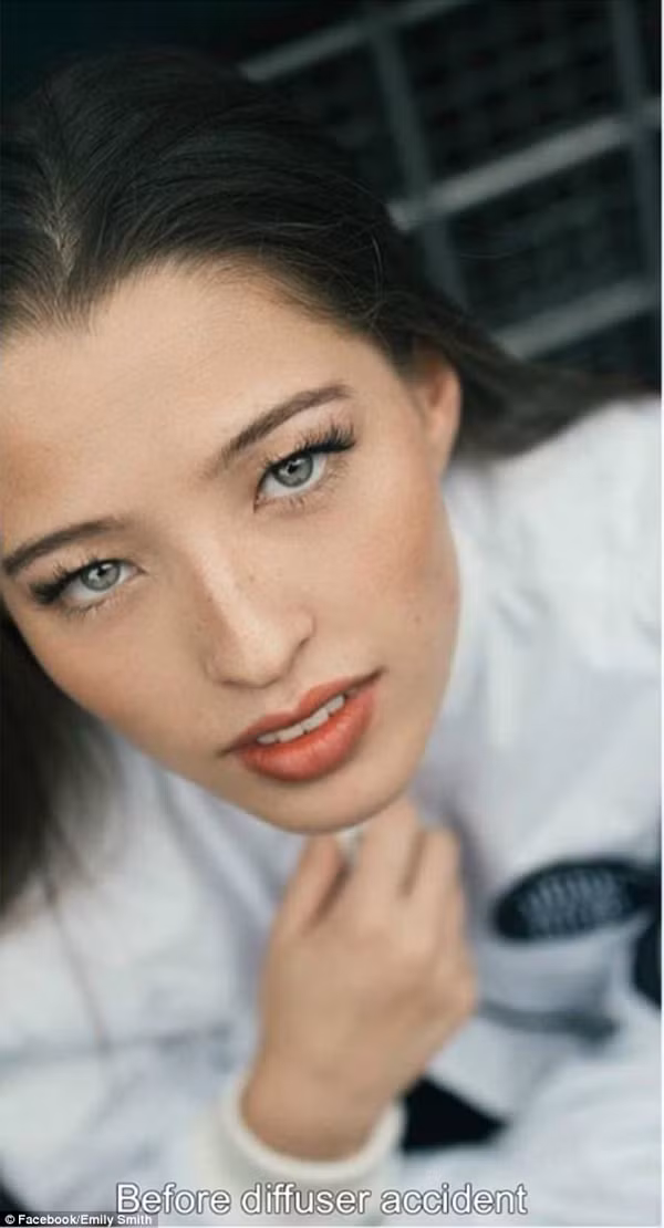 Khuôn mặt Emily trước khi gặp sự cố.