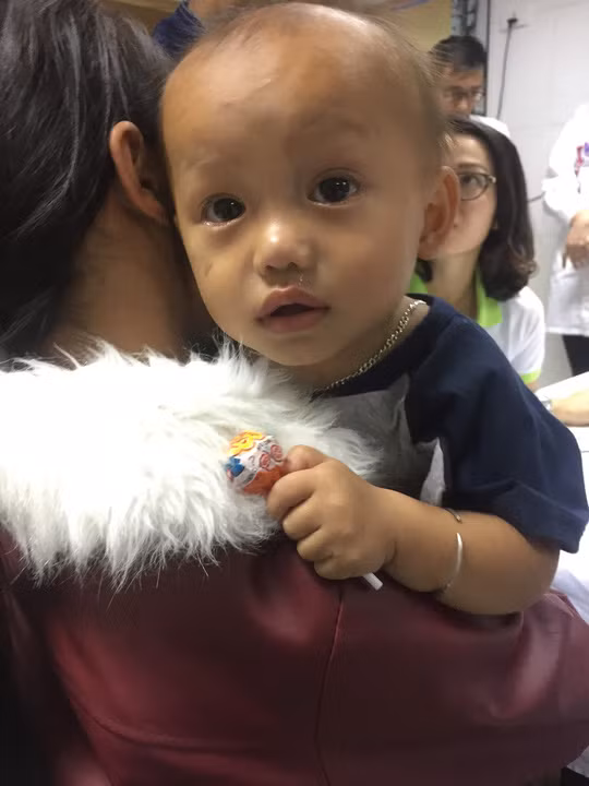 Giàng Mạnh Cần (9 tháng tuổi) không may gặp hoàn cảnh rất đáng thương