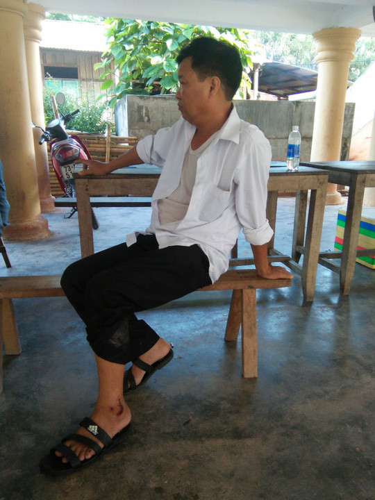 Trung tá Phạm Văn Dũng bị thương Trung tá Phạm Văn Dũng bị thương