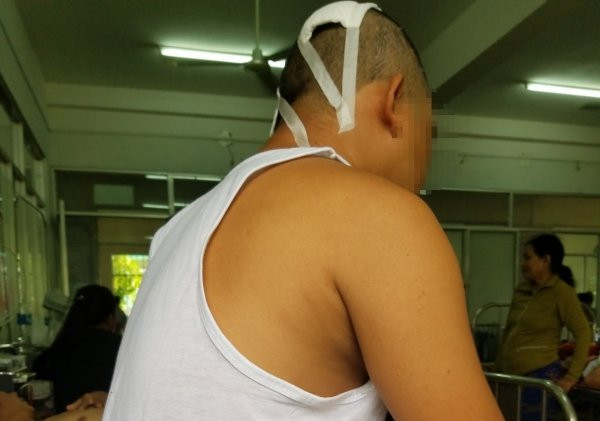 Anh D. đang điều trị tại bệnh viện.