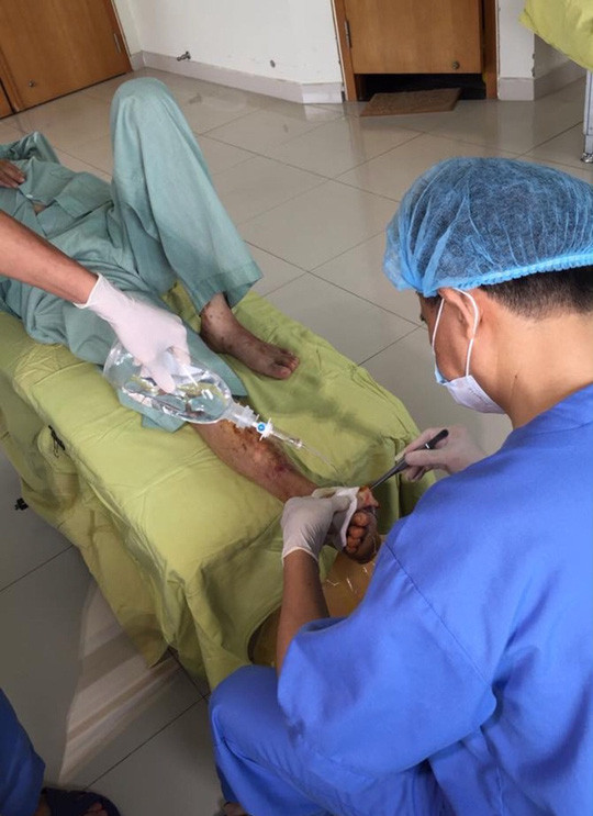 Bác sĩ đang cắt lọc tổn thương bàn chân cho bệnh nhân biến chứng đái tháo đường