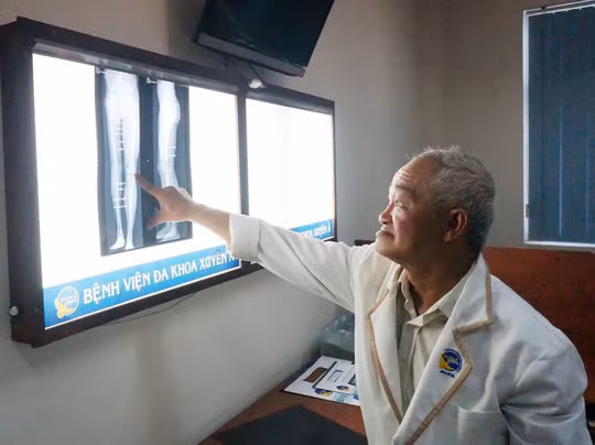 Vị trí cắt xương kéo dài chân cho bệnh nhân Vị trí cắt xương kéo dài chân cho bệnh nhân