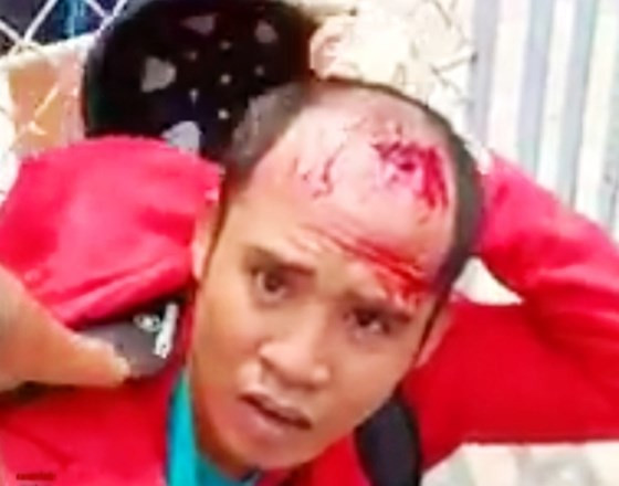  Đối tượng Phương bị người dân và công an bắt giữ