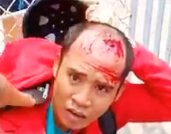 Đối tượng Phương bị người dân và công an bắt giữ Đối tượng Phương bị người dân và công an bắt giữ