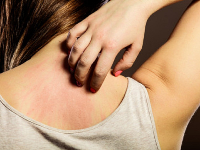 Ảnh minh họa: Shutterstock Ảnh minh họa: Shutterstock