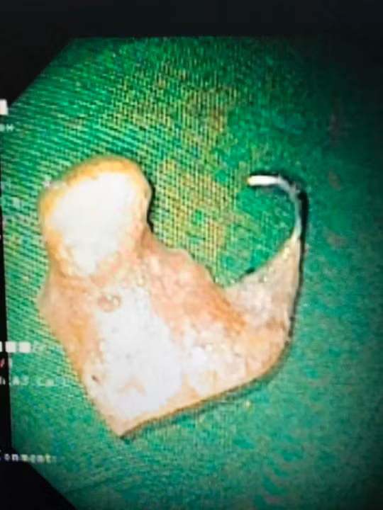 Chiếc móc câu sắc nhọn 