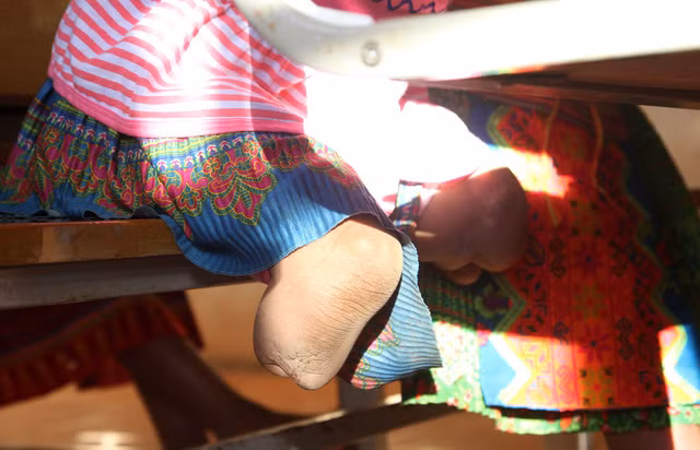 "Hai chân con rụng rồi".