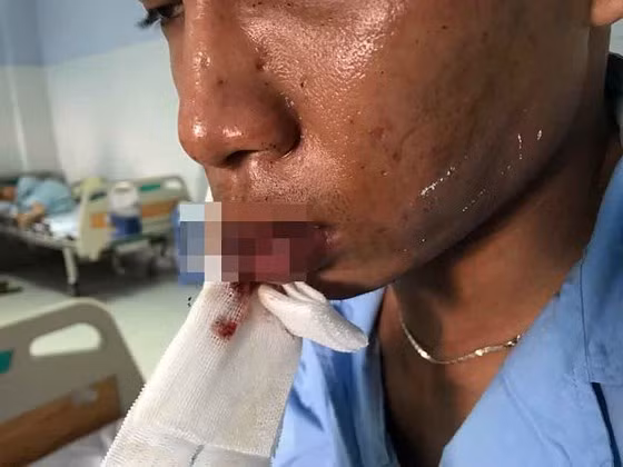 Nam bảo vệ quán bị đánh trọng thương. 