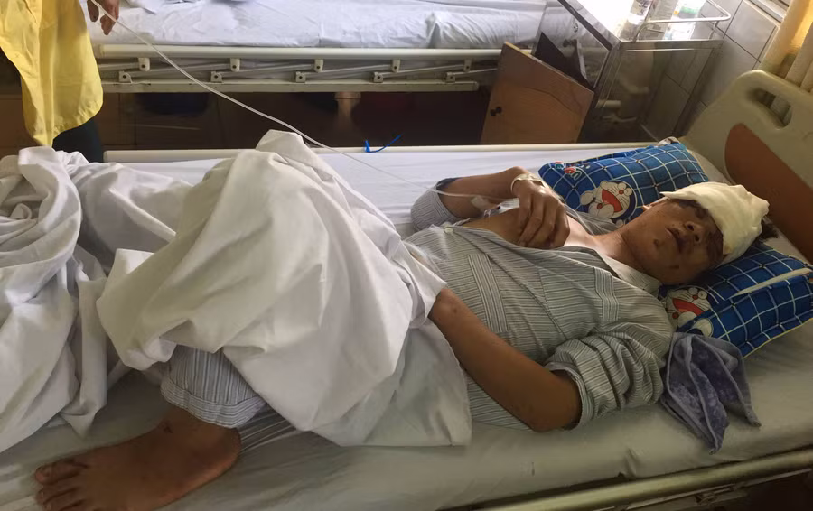 Anh Phúc đang được điều trị tại bệnh viện Đa khoa tỉnh. Ảnh: Văn Ngọc