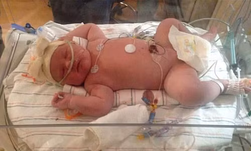 Bé Harper Buckey nặng 6,9 kg. Ảnh: Joy Buckley. Bé Harper Buckey nặng 6,9 kg. Ảnh: Joy Buckley.