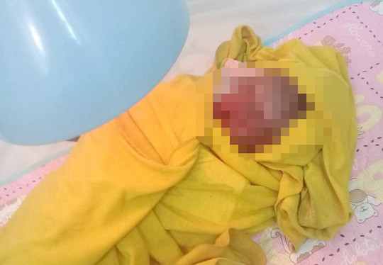 Hiện cháu trai sơ sinh đã qua cơn nguy kịch.