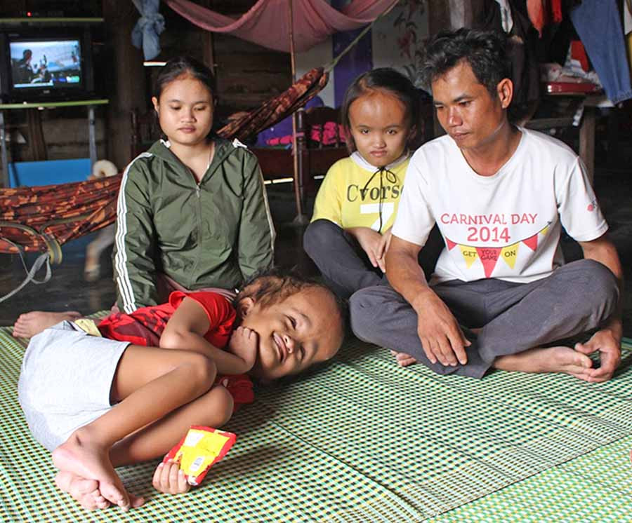  Hoàn cảnh gia đình của anh Ksor Soai rất khó khăn vì có 2 đứa con bị não úng thủy. Ảnh: T.B