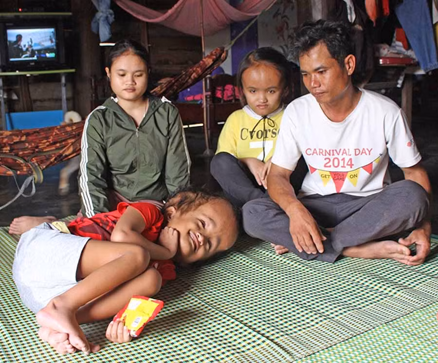  Hoàn cảnh gia đình của anh Ksor Soai rất khó khăn vì có 2 đứa con bị não úng thủy. Ảnh: T.B