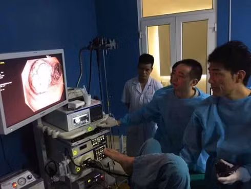  Nội soi phát hiện sớm ung thư đại trực tràng ẢNH: NAM SƠN