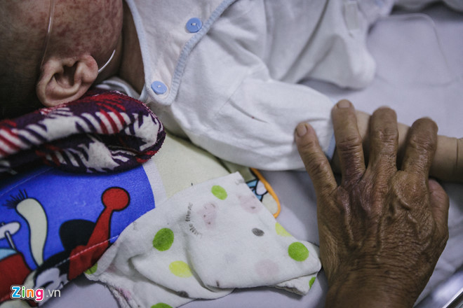 Ngoại trừ những trẻ dưới 9 tháng tuổi thì 95% bệnh nhân sởi còn lại đều không được tiêm chủng. Ảnh: Liêu Lãm  Ngoại trừ những trẻ dưới 9 tháng tuổi thì 95% bệnh nhân sởi còn lại đều không được tiêm chủng. Ảnh: Liêu Lãm