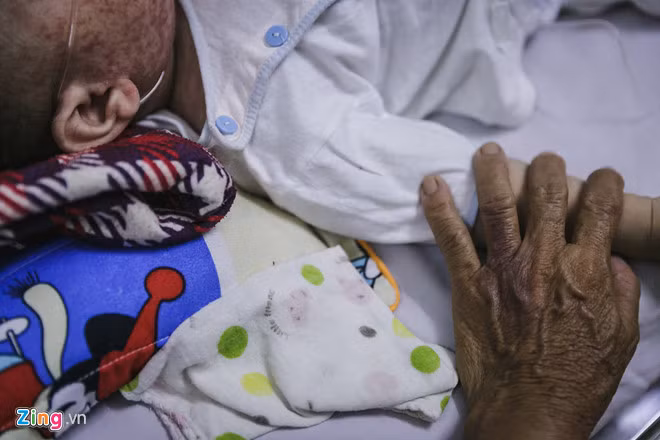 Ngoại trừ những trẻ dưới 9 tháng tuổi thì 95% bệnh nhân sởi còn lại đều không được tiêm chủng. Ảnh: Liêu Lãm Ngoại trừ những trẻ dưới 9 tháng tuổi thì 95% bệnh nhân sởi còn lại đều không được tiêm chủng. Ảnh: Liêu Lãm