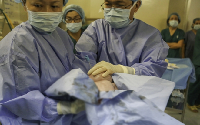  Em bé đã được bác sĩ đặt nội khí quản, chào đời thành công