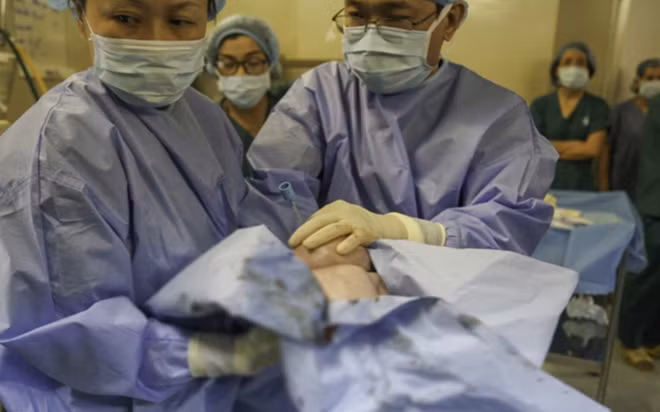  Em bé đã được bác sĩ đặt nội khí quản, chào đời thành công