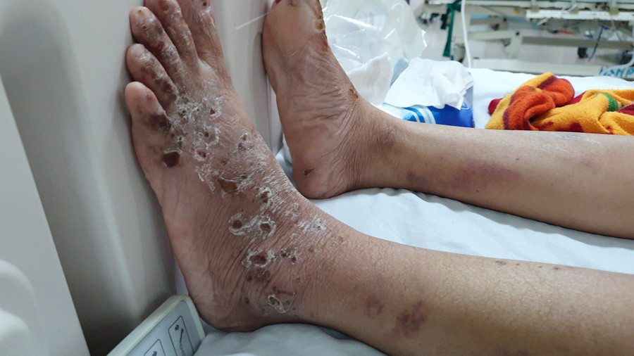 Kết quả giám định, chị T. bị tỷ lệ thương tích 96% - ẢNH: LÊ LÂM Kết quả giám định, chị T. bị tỷ lệ thương tích 96% - ẢNH: LÊ LÂM