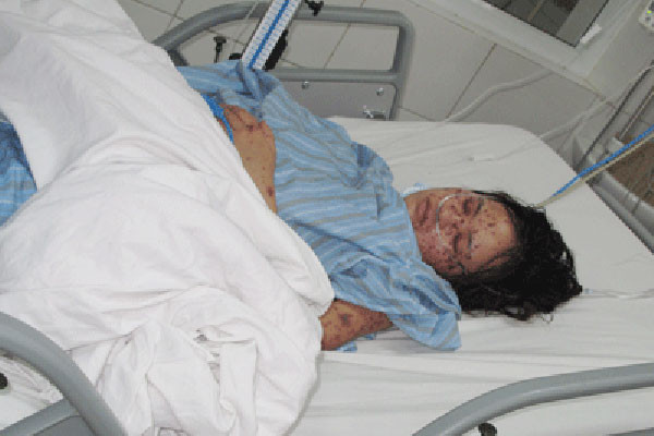 Hà Nội cũng đã ghi nhận 2 bệnh nhân bị bệnh viêm não mô cầu.