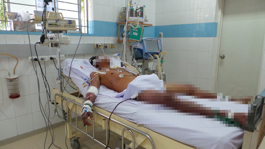 Ca nhiễm liên cầu lợn nặng vừa được Bệnh viện Chợ Rẫy cứu sống  Ca nhiễm liên cầu lợn nặng vừa được Bệnh viện Chợ Rẫy cứu sống