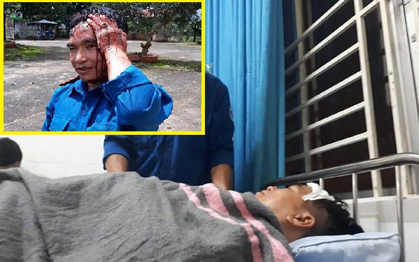 Nhân viên Công ty Cổ phần Tập đoàn Tân Mai bị chém trọng thương đang được điều trị tại bệnh viện. Nhân viên Công ty Cổ phần Tập đoàn Tân Mai bị chém trọng thương đang được điều trị tại bệnh viện.