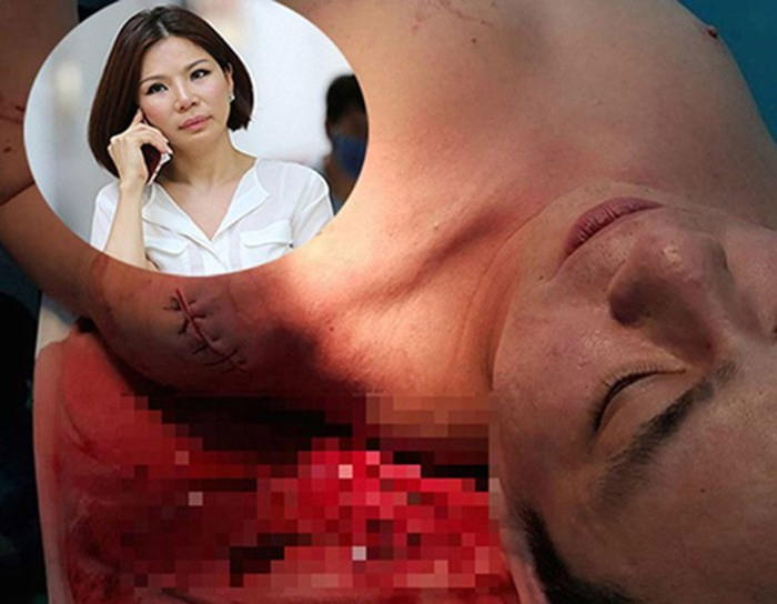 Kế hoạch truy sát bác sĩ Chiêm Quốc Thái được nhóm giang hồ núp bóng công ty bảo vệ thực hiện rất kỹ lưỡng. Bà Ngọc bị cáo buộc có vai trò chủ mưu