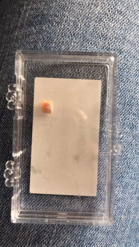  Chiếc răng bé nhỏ của Isla-Rose - ảnh do gia đình cung cấp